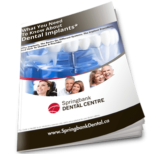 dental implants guide cover