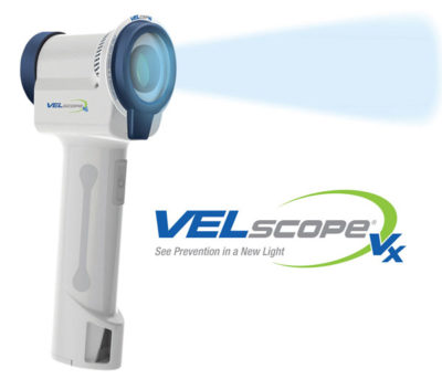 photo of velscope